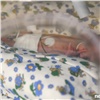 В Красноярске родилась девочка весом 530 граммов 