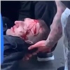 Полицейские разбираются в обстоятельствах кровавого побоища в Назаровском районе (видео)
