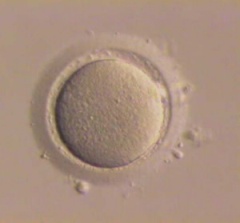 Женская яйцеклетка